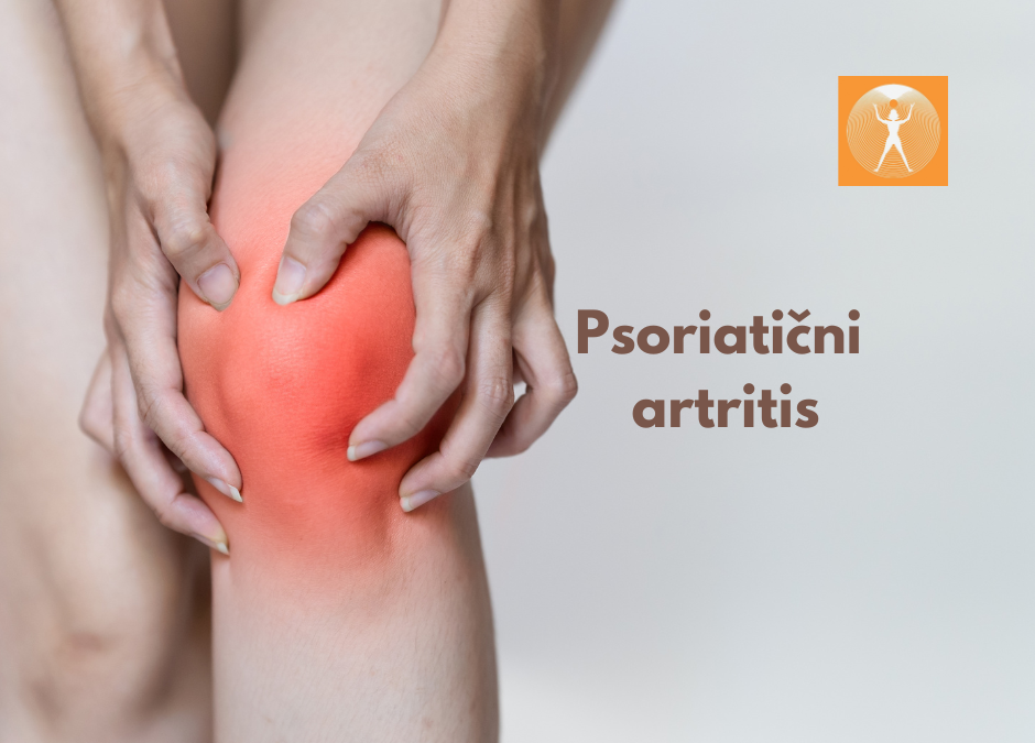 Psoriatični artritis